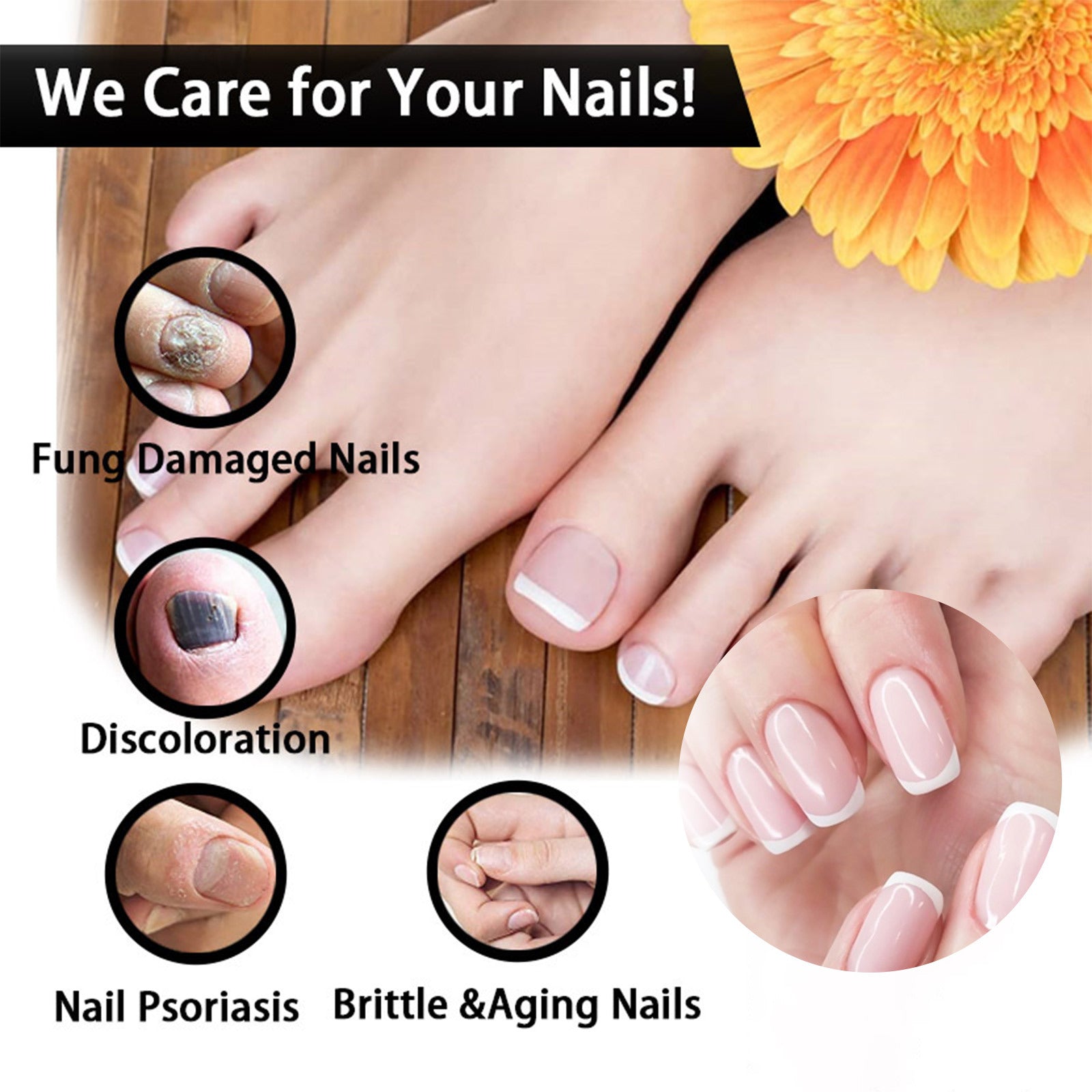 Nail Repair Solution Thickening And Shining Nail Removal Dead Skin Repairing And Moisturizing Nail Nutritional Care Liquid
