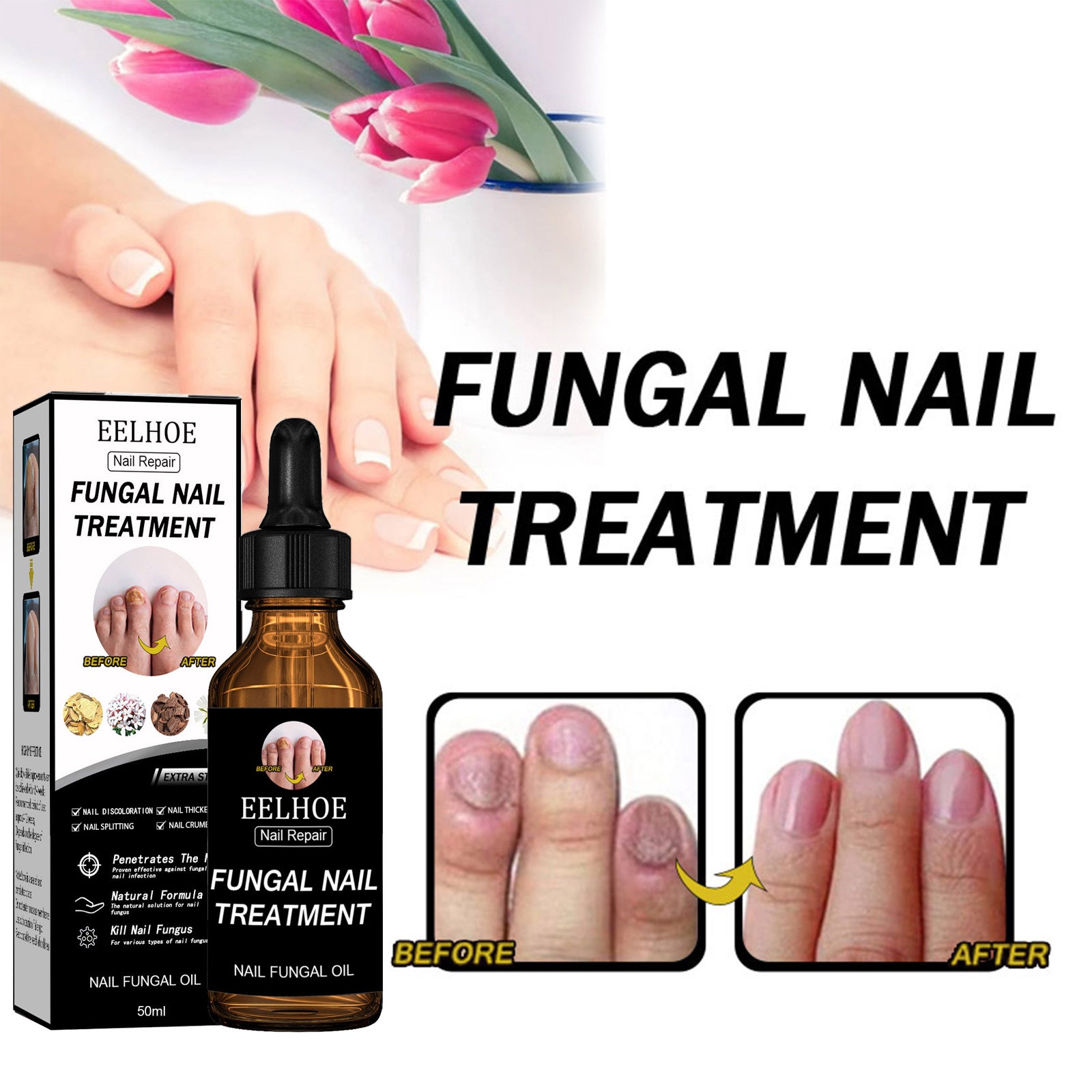 Nail Repair Solution Thickening And Shining Nail Removal Dead Skin Repairing And Moisturizing Nail Nutritional Care Liquid